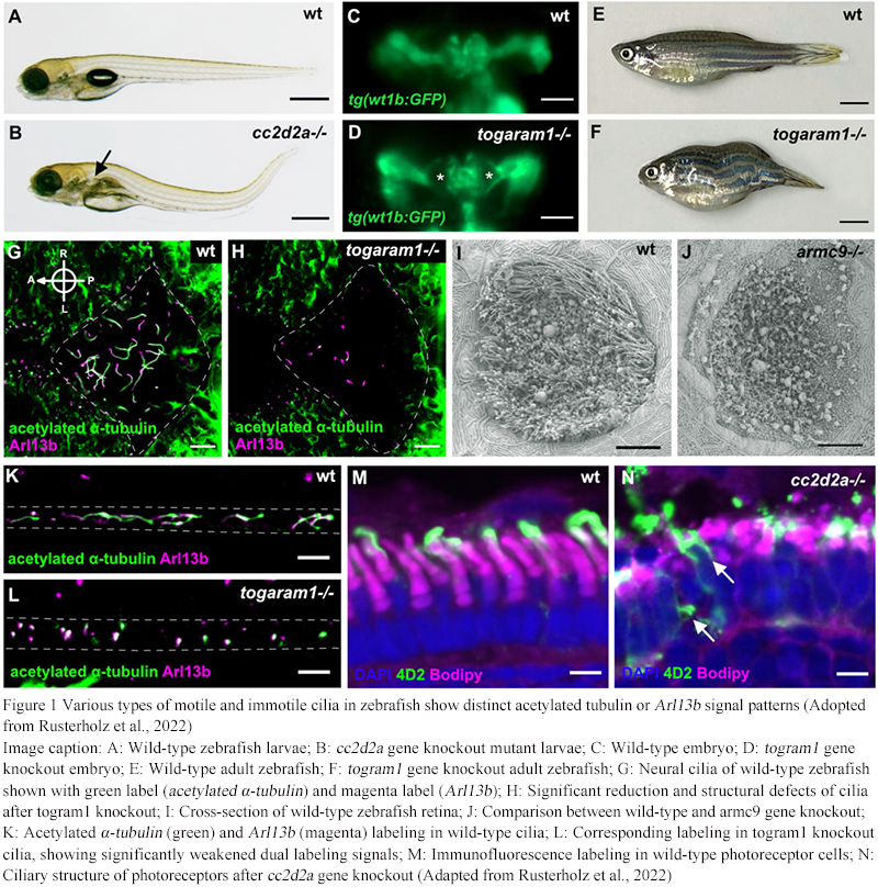 Zebrafish as a Model for Studying Ciliary Development and Disease ...
